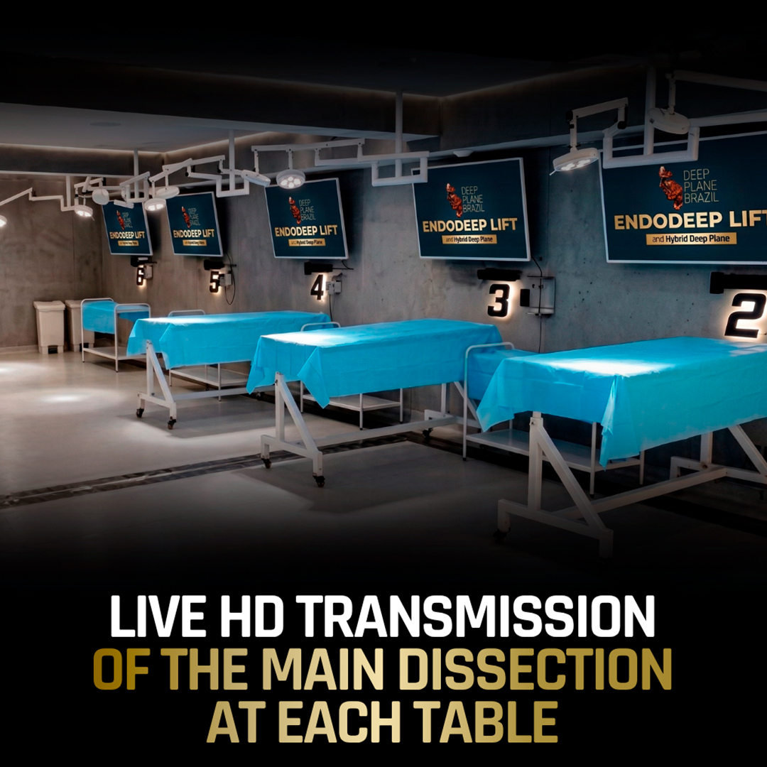 Live HD Transmission